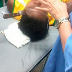 Mulher crava faca na cabeça de rival