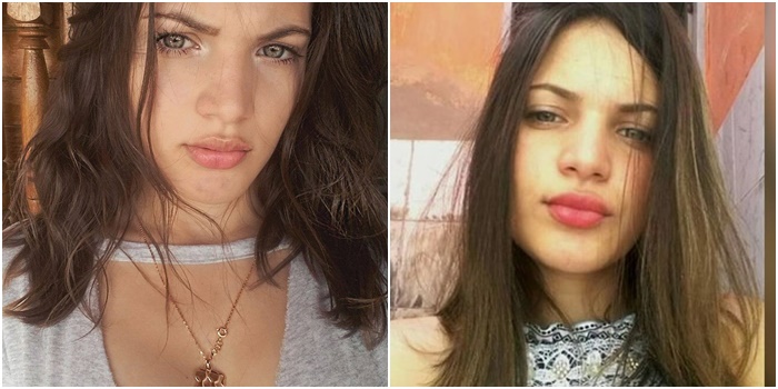 Universitária queimada pelo próprio pai morre após lutar 11 dias pela vida