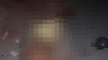 Homem leva tiro na cabeça e sobrevive a tentativa de homicídio em Paulo Afonso