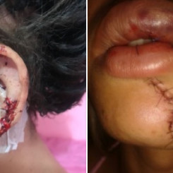 Perseguidor de travestis ataca na BA; três foram esfaqueadas