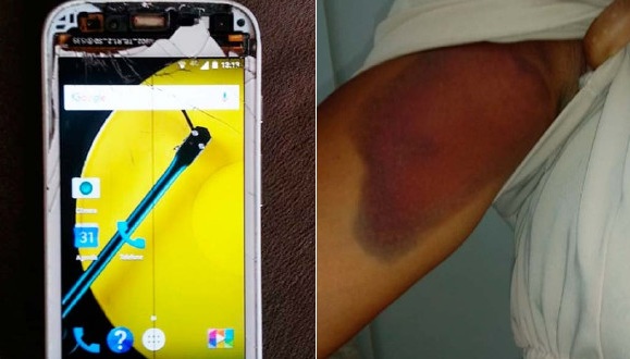 Vítima de assalto na BA relata coronhada após ladrão ver tela de celular quebrada e reclamar de aparelho: ‘Não tem outro?’