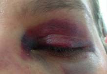 Mulher denuncia primo por agressão física na área rural de Paulo Afonso