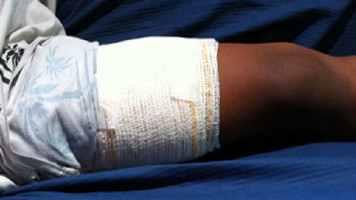 Homem é atingido com tiro na perna em Paulo Afonso