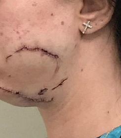 Servidor que agrediu mulher durante orgia é exonerado