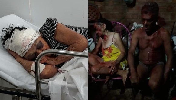 Morre idosa de 81 anos espancada por bandidos após assalto no MA; imagens fortes