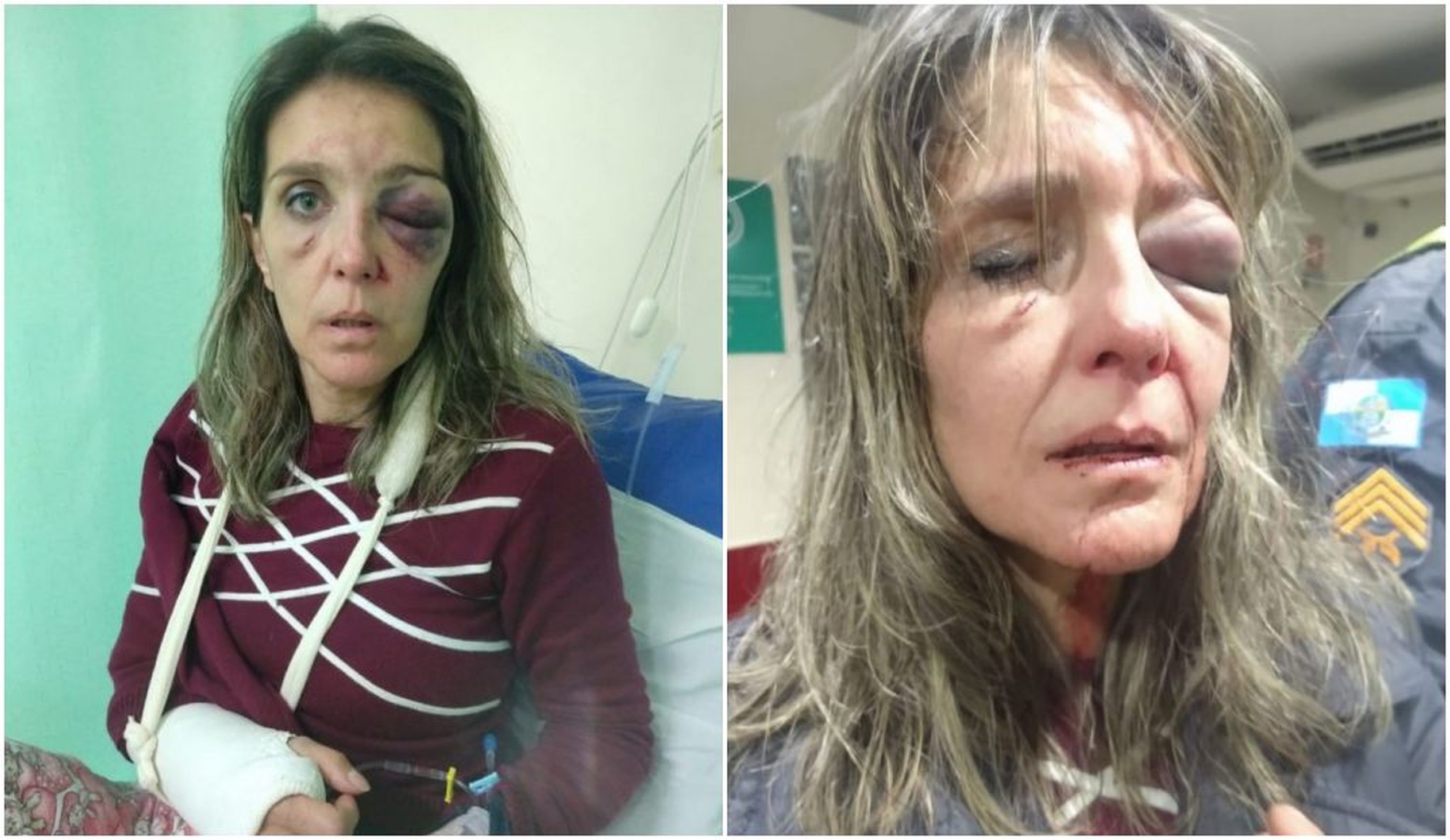 Mulher agredida com socos recebeu mensagem de arrependimento do companheiro: ‘Te amo demais’