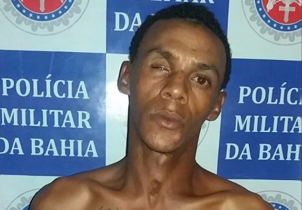 Paulo Afonso: Renata tem dois motivos para comemorar: venceu o câncer e foi aprovada em Medicina