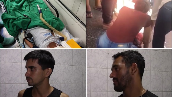 Menina atacada por cão pitbull teve fratura de crânio e desfiguração da face; veja depoimentos da família