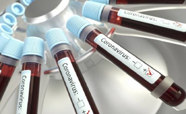 Bahia registra 9 óbitos por Covid-19 em 24 horas, com total 1.845 casos confirmados