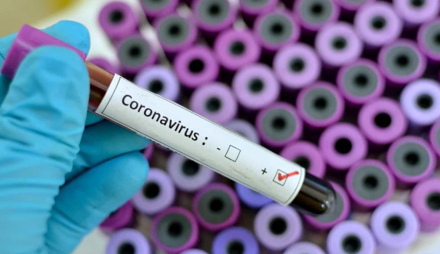 Coronavírus: Saúde se corrige e diz que houve 113 mortes em 24 horas e não 383