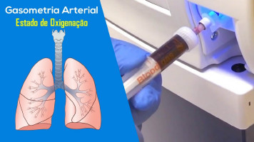 HMPA conta com serviços de gasometria arterial que auxilia no tratamento da Covid-19