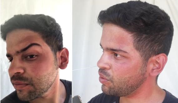 Jornalista é agredido por funcionário da prefeitura de Paulo Afonso durante reportagem na UPA Covid; governo emite nota