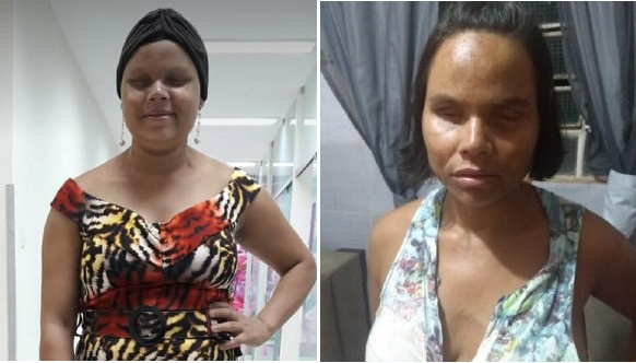 Morre em Paulo Afonso, após lutar 4 anos contra o câncer, Daniela Alexandra, aos 27 anos