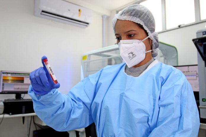 Lacen identifica variante da linhagem peruana C.14 do vírus Sars Cov 2 em circulação na Bahia