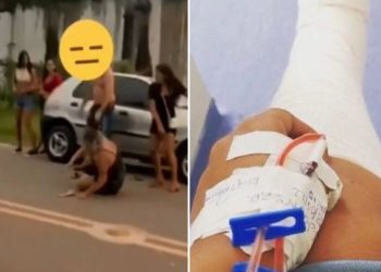 Mulher agredida por homem no meio da rua em Água Branca (AL) é hospitalizada; delegado intima agressor