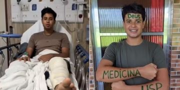 Baiano que passou em 1º lugar em Medicina na USP deixa a UTI após complicações em cirurgia